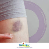 Boiron Arnicare Bruise Gel Relief for Pain, Bumps, Oedema and Swelling - Non-greasy and Fragrance-Free, A natural health product made with 100% naturally-sourced medicinal ingredients, featuring a quick-absorbing gel texture and easy to carry anywhere. Fo