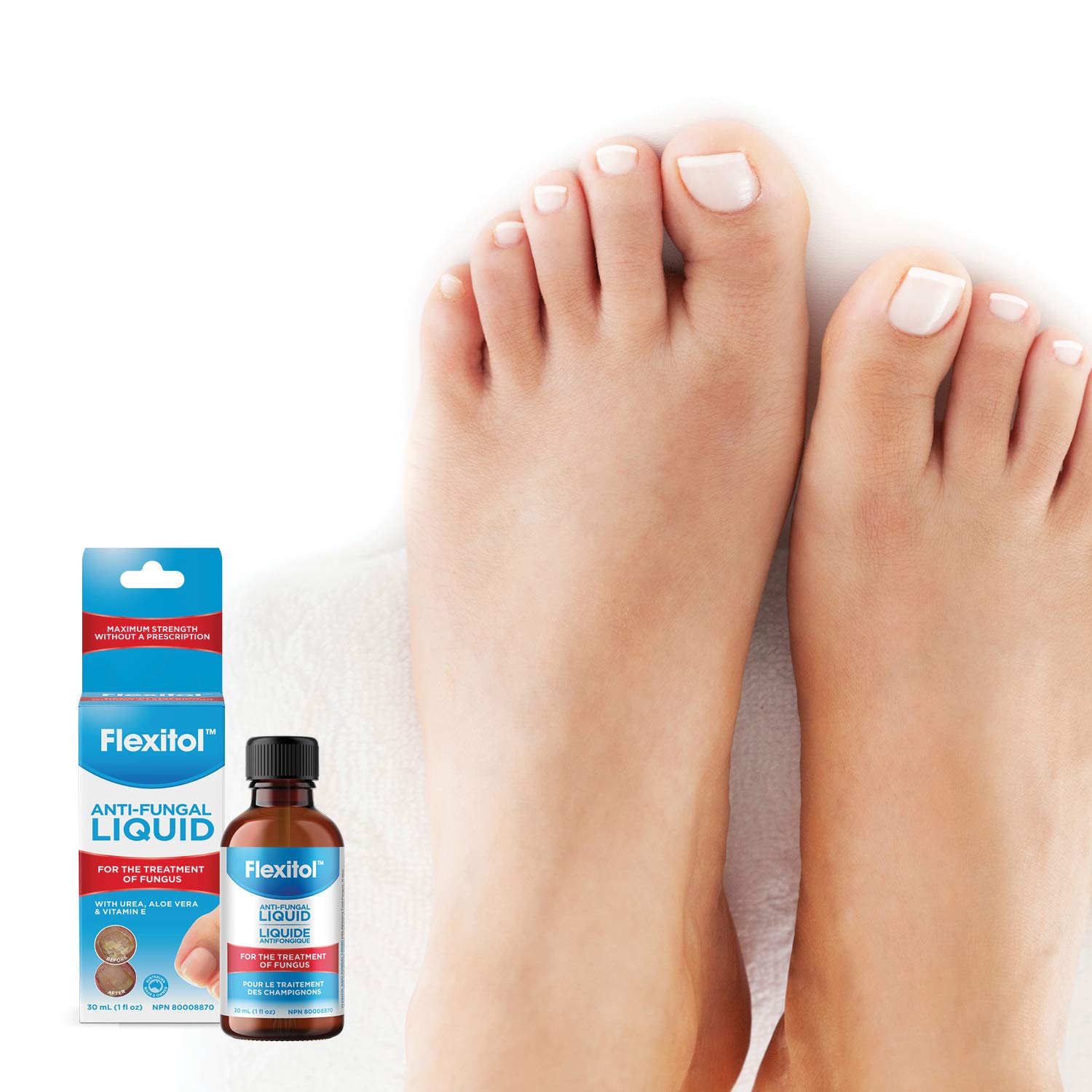 Flexitol Anti-Fungal Liquid - OTC Undecylenic Acid Treatment for Nail Fungus, Effective Over-the-Counter Cure for Toenail & Fingernail Fungal Infection (30ml)